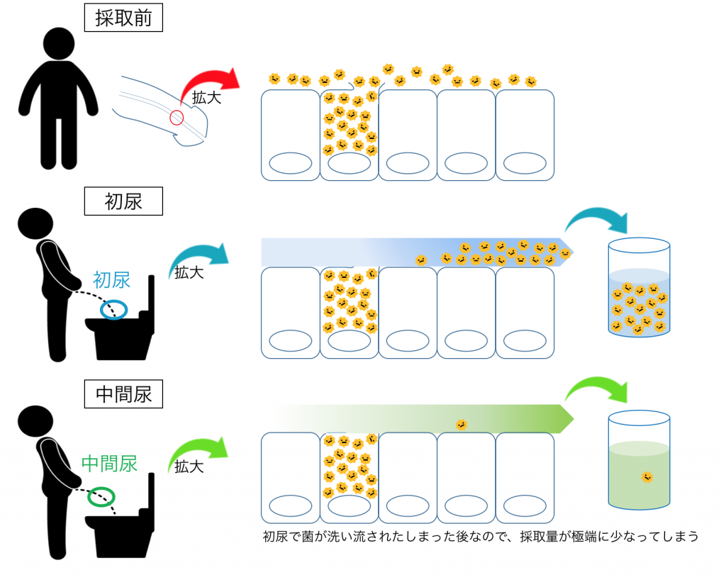 検査　しょにょう　中間尿　尿検査の仕方