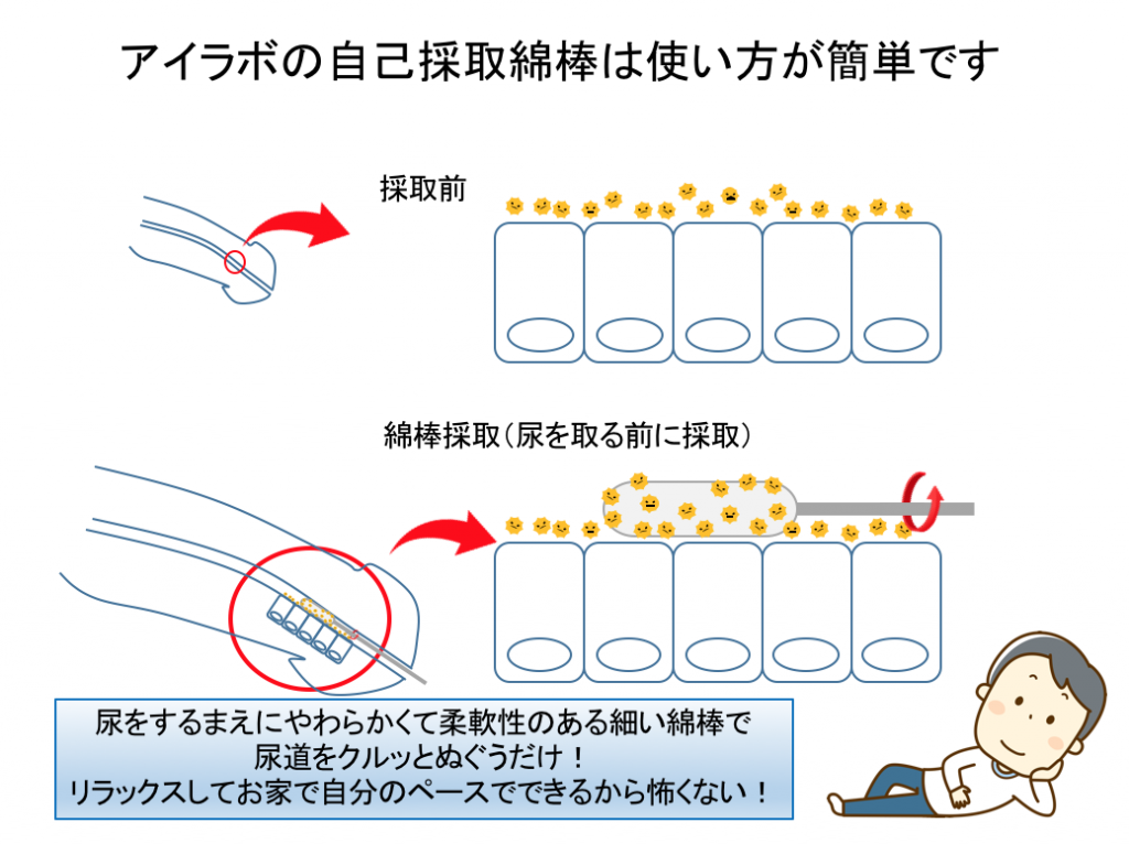 男性尿道採取用の綿棒は細く、尿道分泌物やぬぐい液の採取は簡単にすみます