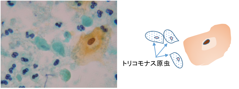 トリコモナスの細胞像とその説明イラスト