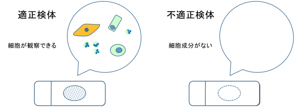 顕微鏡で検体が適正化不適正か確認します