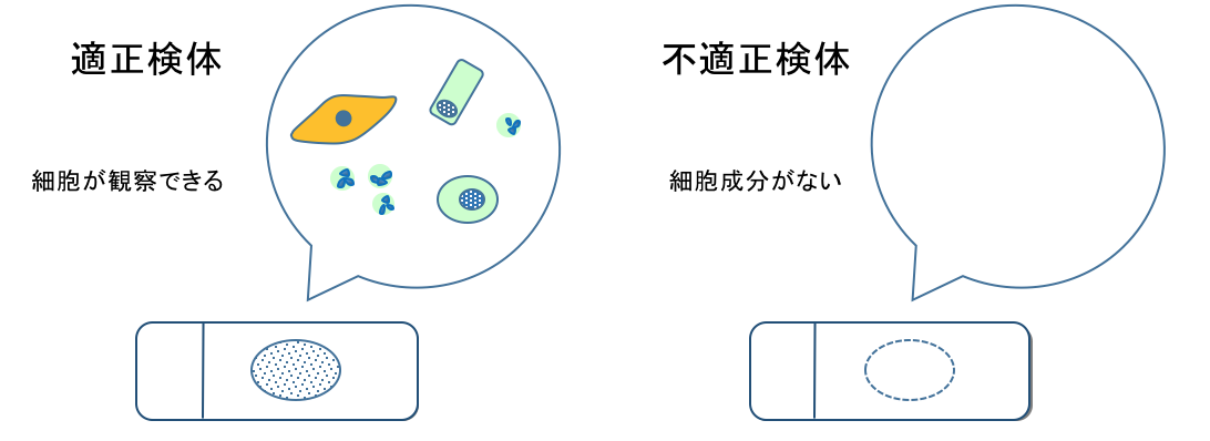 細胞量の確認をし、きちんとした検査が行えるかどうか判断します
