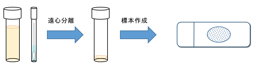 検査前の処理として、遠心分離して細胞成分の濃縮を行います
