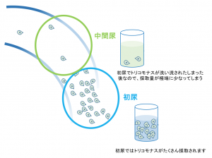 トリコモナスの検査は初尿採取が大切です