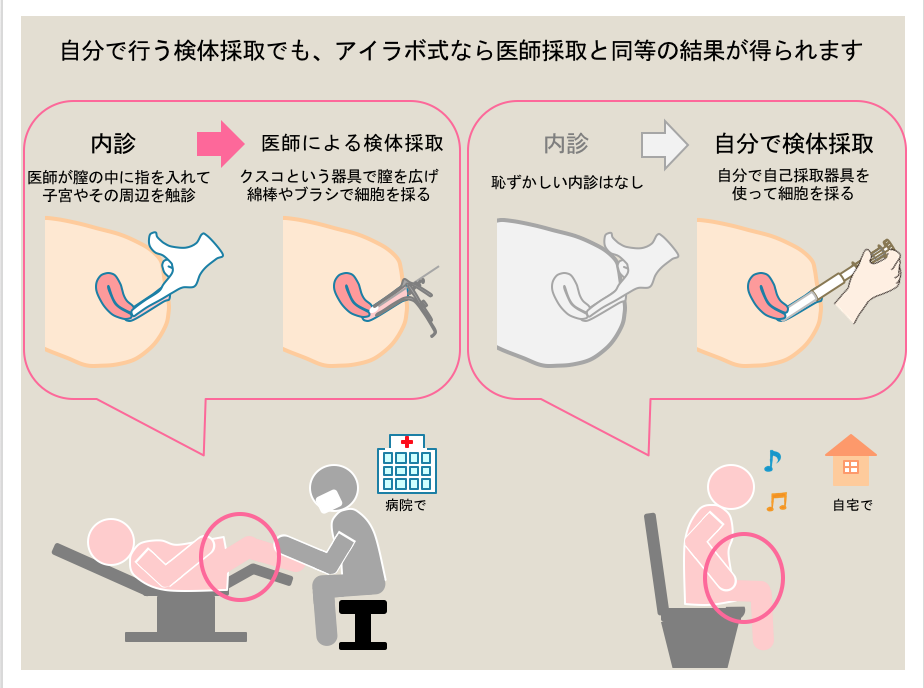 医師採取と自己採取　子宮頸がん