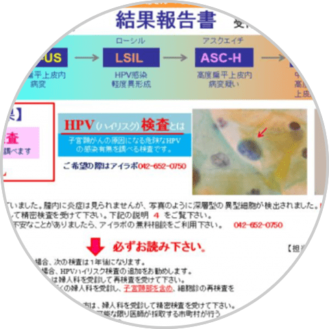 検査結果が分かりやすい！
