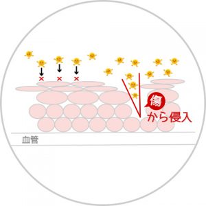 HPVウイルスは傷から侵入して感染します
