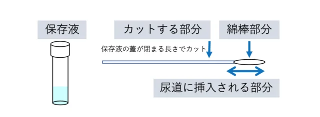 尿道擦過用の綿棒と保存液の説明
