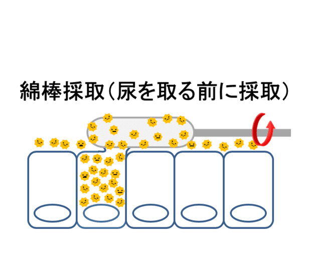 尿道分泌物もしくはぬぐい液の採取