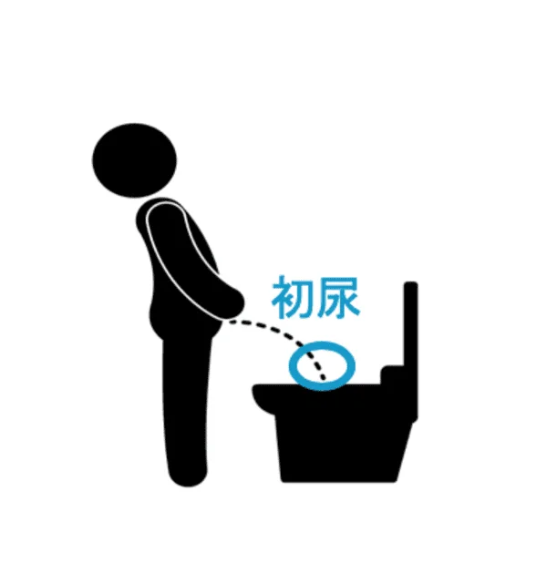 尿の採取