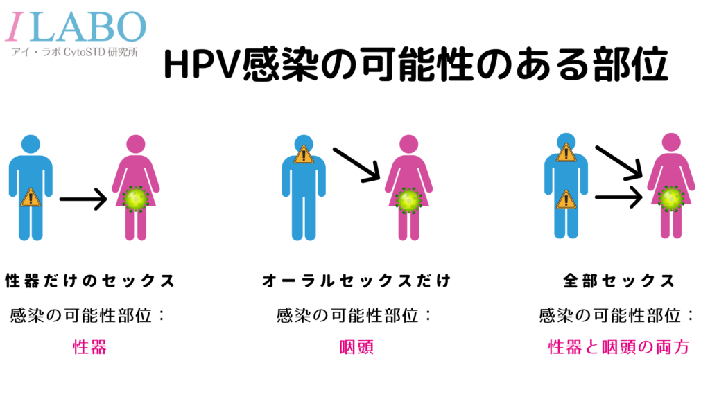 HPV感染　咽頭