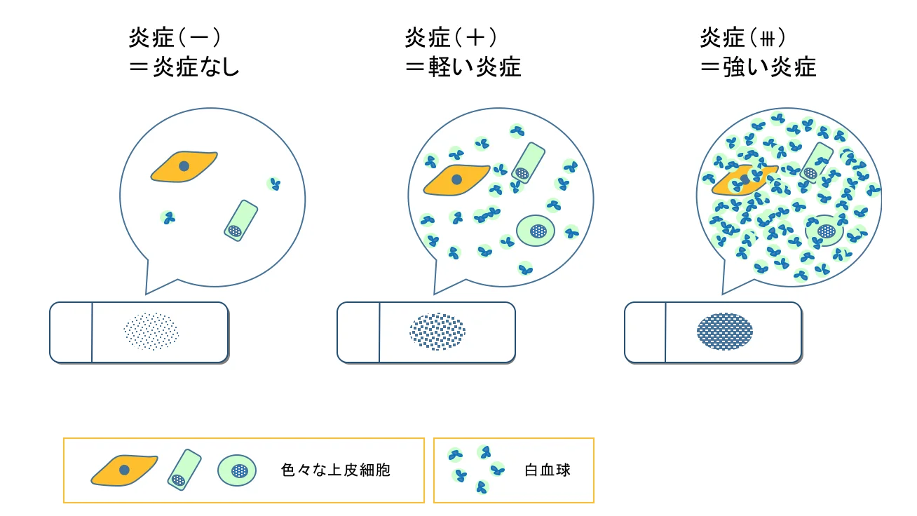 炎症の有無とその程度を観察します